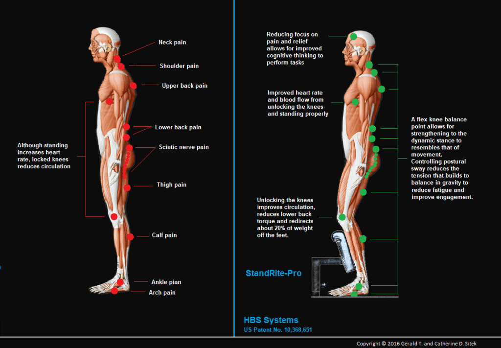 Improving Posture